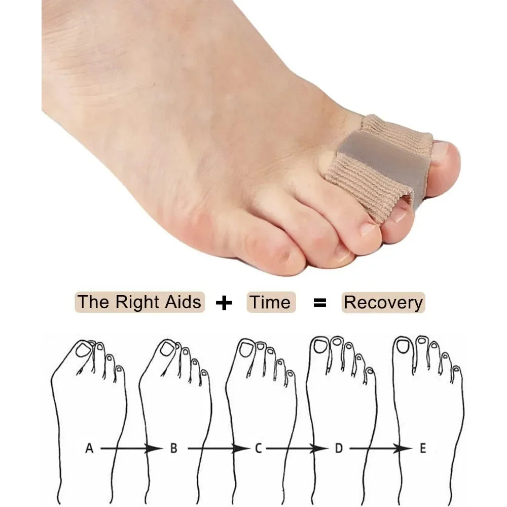 Two Toe Separator Bunion Corrector Orthotics Foot Bone Adjuster Pedicure Correction Foot Straightener