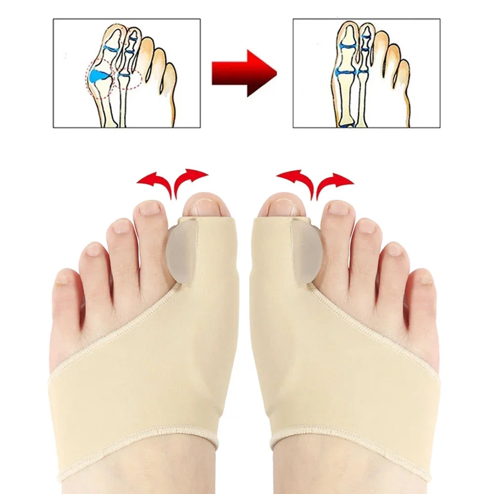 Orthopedic Bunion Corrector Feet Thumb Bone Adjuster and Corrector